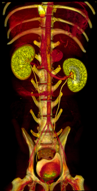 Spine View CT Imaging